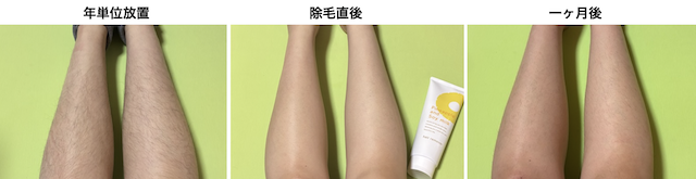 パイナップル豆乳除毛クリーム使用前・直後・1ヶ月後の比較